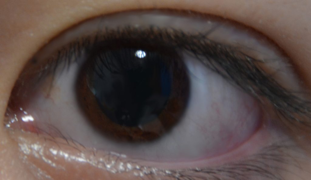 Self-portrait of the photographer's own eye, revealing a dark brown iris and a dilated pupil.