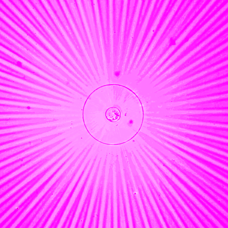 A pink explosion-looking image